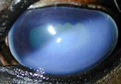 akute Uveitis mit Hornhautödem